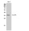 Cysteinyl leukotriene receptor 1 antibody, STJ92609, St John