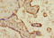 MAPK Activated Protein Kinase 3 antibody, LS-C676019, Lifespan Biosciences, Immunohistochemistry paraffin image 