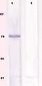 Ribosomal Protein S6 Kinase B1 antibody, TA354562, Origene, Western Blot image 