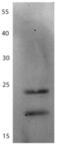 HIV1 gp41 antibody, DDX1306, Novus Biologicals, Western Blot image 