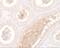 WW Domain Containing Adaptor With Coiled-Coil antibody, GTX32115, GeneTex, Immunohistochemistry paraffin image 