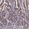 DENN Domain Containing 4B antibody, HPA071133, Atlas Antibodies, Immunohistochemistry frozen image 
