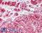 SNCG antibody, LS-B7908, Lifespan Biosciences, Immunohistochemistry paraffin image 