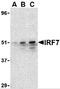 Interferon regulatory factor 7 antibody, 3941, ProSci Inc, Western Blot image 