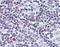 Survivin antibody, orb96468, Biorbyt, Immunohistochemistry paraffin image 