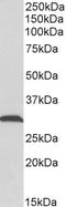 ATP Synthase F1 Subunit Gamma antibody, TA329086, Origene, Western Blot image 