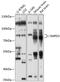 Sphingomyelin phosphodiesterase 3 antibody, 13-492, ProSci, Western Blot image 