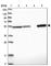 Aldehyde Dehydrogenase 7 Family Member A1 antibody, HPA023296, Atlas Antibodies, Western Blot image 
