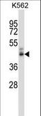 PPYR1 antibody, LS-C162103, Lifespan Biosciences, Western Blot image 
