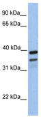 FKBP Prolyl Isomerase 8 antibody, TA341898, Origene, Western Blot image 