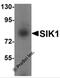 Salt Inducible Kinase 1 antibody, 6299, ProSci, Western Blot image 