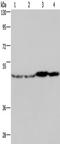 Fumarate Hydratase antibody, TA349999, Origene, Western Blot image 