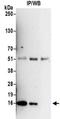 PCNA Clamp Associated Factor antibody, NBP2-32117, Novus Biologicals, Western Blot image 
