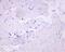Tumor Protein P63 antibody, ab124762, Abcam, Immunohistochemistry paraffin image 