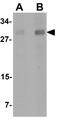 Autophagy-related protein 101 antibody, GTX31415, GeneTex, Western Blot image 