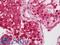 Histone-lysine N-methyltransferase SETD2 antibody, LS-B12660, Lifespan Biosciences, Immunohistochemistry paraffin image 