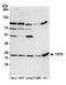YKT6 V-SNARE Homolog antibody, A305-480A, Bethyl Labs, Western Blot image 