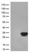 Dual specificity protein phosphatase 3 antibody, M06135, Boster Biological Technology, Western Blot image 