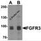 Fibroblast Growth Factor Receptor 3 antibody, 7425, ProSci, Western Blot image 