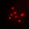 Tumor Protein P63 antibody, LS-C353074, Lifespan Biosciences, Immunofluorescence image 