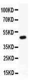 Potassium Voltage-Gated Channel Subfamily B Member 1 antibody, PA5-79551, Invitrogen Antibodies, Western Blot image 
