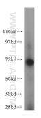 BRCA1/BRCA2-Containing Complex Subunit 3 antibody, 15391-1-AP, Proteintech Group, Western Blot image 