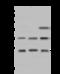 Cytochrome B561 Family Member D1 antibody, 203730-T36, Sino Biological, Western Blot image 