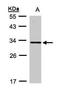Dual Adaptor Of Phosphotyrosine And 3-Phosphoinositides 1 antibody, PA5-28575, Invitrogen Antibodies, Western Blot image 