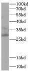 Apolipoprotein B MRNA Editing Enzyme Catalytic Subunit 3A antibody, FNab10020, FineTest, Western Blot image 