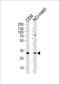 Core histone macro-H2A.2 antibody, A09931, Boster Biological Technology, Western Blot image 