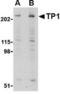 p240 antibody, TA306057, Origene, Western Blot image 