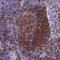 SLP-65 antibody, NBP2-14355, Novus Biologicals, Immunohistochemistry frozen image 