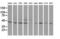 Ornithine Decarboxylase 1 antibody, GTX83968, GeneTex, Western Blot image 