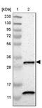 Carbonate dehydratase VB antibody, PA5-52959, Invitrogen Antibodies, Western Blot image 