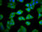 RIO Kinase 2 antibody, LS-C681212, Lifespan Biosciences, Immunofluorescence image 
