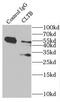 Clathrin Light Chain B antibody, FNab01778, FineTest, Immunoprecipitation image 