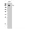 EPHB1 antibody, LS-C383370, Lifespan Biosciences, Western Blot image 