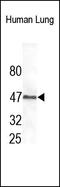 Paired Box 6 antibody, 251935, Abbiotec, Western Blot image 