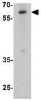 Zinc finger protein GLIS2 antibody, GTX32148, GeneTex, Western Blot image 