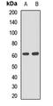 Prolyl 4-Hydroxylase Subunit Alpha 1 antibody, orb411795, Biorbyt, Western Blot image 