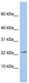Junctional Adhesion Molecule 3 antibody, TA339629, Origene, Western Blot image 