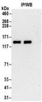 Tubulin Tyrosine Ligase Like 5 antibody, NBP2-32091, Novus Biologicals, Immunoprecipitation image 