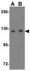 OTU Deubiquitinase 4 antibody, GTX17037, GeneTex, Western Blot image 