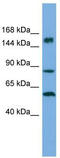 HECT And RLD Domain Containing E3 Ubiquitin Protein Ligase 3 antibody, TA329871, Origene, Western Blot image 