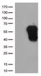 Hepatitis A Virus Cellular Receptor 2 antibody, CF812588, Origene, Western Blot image 