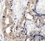 ABL Proto-Oncogene 1, Non-Receptor Tyrosine Kinase antibody, abx000351, Abbexa, Western Blot image 
