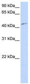 Cyclin Dependent Kinase 18 antibody, TA330356, Origene, Western Blot image 