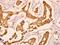 TPX2 Microtubule Nucleation Factor antibody, GTX66708, GeneTex, Immunohistochemistry paraffin image 