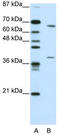 Grainyhead Like Transcription Factor 3 antibody, TA345327, Origene, Western Blot image 