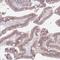 Zinc Finger Protein 576 antibody, NBP2-13584, Novus Biologicals, Immunohistochemistry paraffin image 